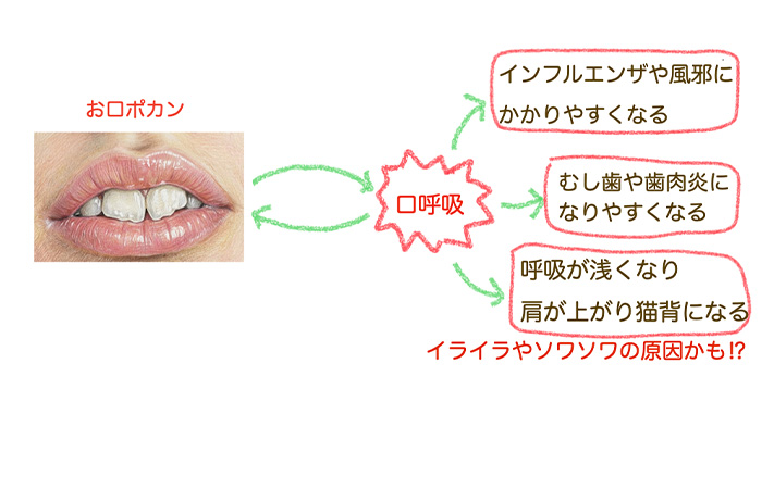 お口ポカンと口呼吸